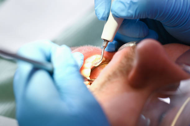 Best Teeth Whitening  in Bellaire, OH