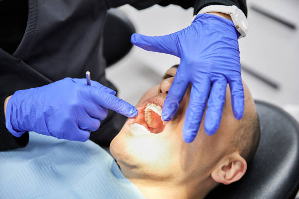 Best Dentist for Tooth Abscess  in Bellaire, OH